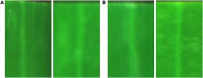 Detecting Asymptomatic Infections of Rice Bacterial Leaf Blight Using Hyperspectral Imaging and 3-Dimensional Convolutional Neural Network With Spectral Dilated Convolution